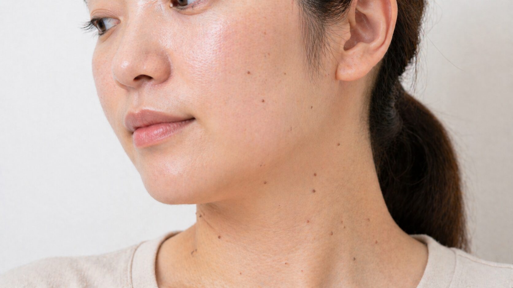 顔から首にかけてイボがある女性