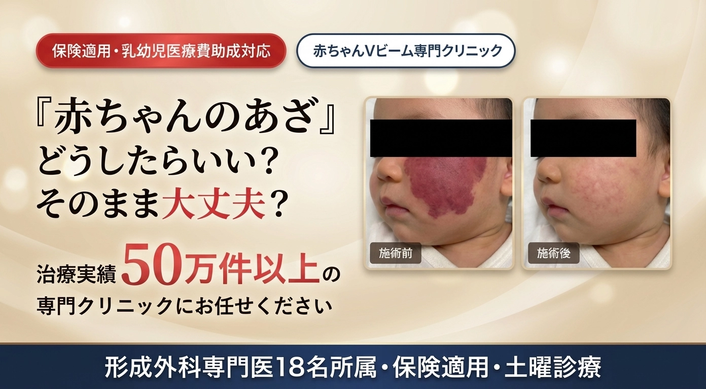 【裁断済】スキルアップ皮膚レーザー治療 AIを用いた顔のシミの高精度診断支援システム開発に成功 レーザー治療