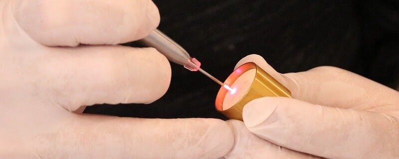 Tratamientos para el siringoma disponibles en la clínica