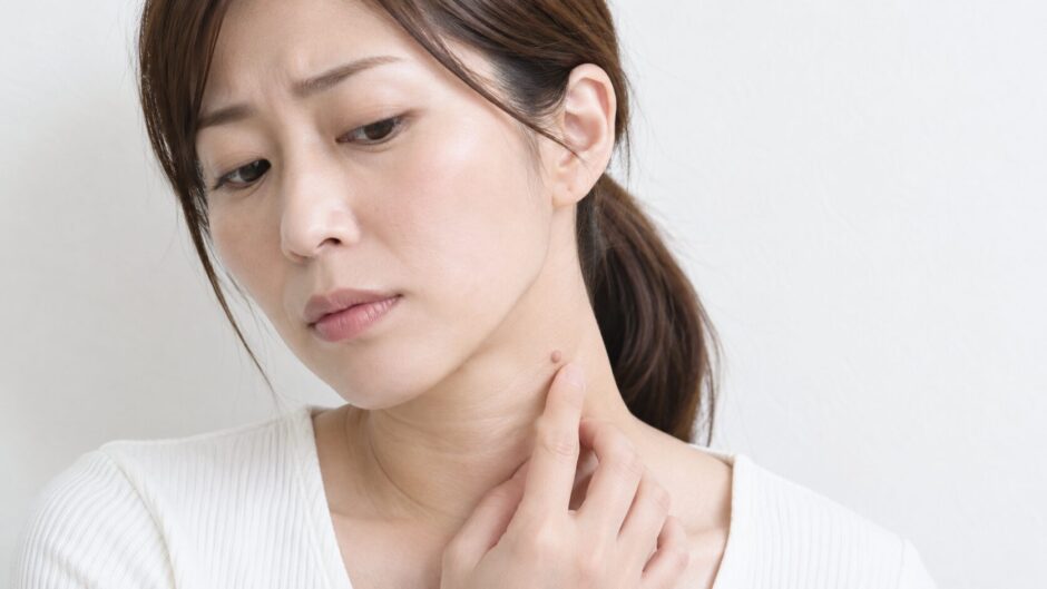 首のイボを気にして触れている女性